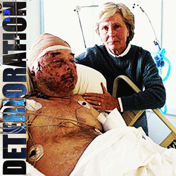 Deterioration : Hold on to Your Happy Thoughts